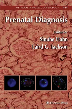 Hahn / Jackson |  Prenatal Diagnosis | Buch |  Sack Fachmedien