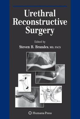 Brandes |  Urethral Reconstructive Surgery | Buch |  Sack Fachmedien