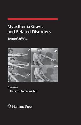 Kaminski |  Myasthenia Gravis and Related Disorders | Buch |  Sack Fachmedien