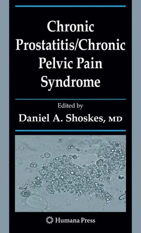 Shoskes |  Chronic Prostatitis/Chronic Pelvic Pain Syndrome | Buch |  Sack Fachmedien