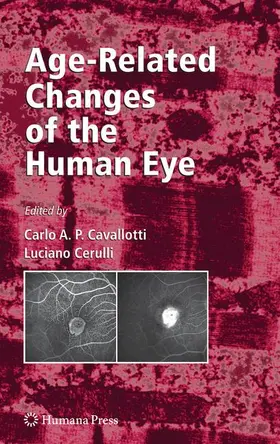 Cavallotti / Cerulli |  Age-Related Changes of the Human Eye | Buch |  Sack Fachmedien