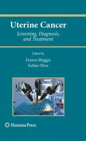 Oliva / Muggia |  Uterine Cancer | Buch |  Sack Fachmedien