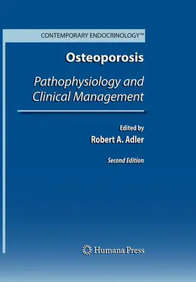 Adler |  Osteoporosis | Buch |  Sack Fachmedien