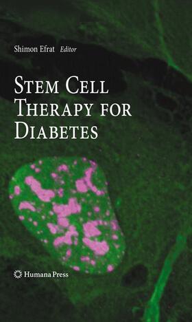 Efrat |  Stem Cell Therapy for Diabetes | Buch |  Sack Fachmedien
