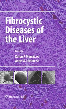 Larson / Murray |  Fibrocystic Diseases of the Liver | Buch |  Sack Fachmedien