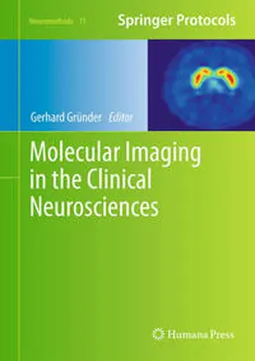 Gründer |  Molecular Imaging in the Clinical Neurosciences | eBook | Sack Fachmedien