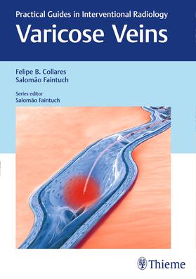 Collares / Faintuch |  Varicose Veins | eBook | Sack Fachmedien