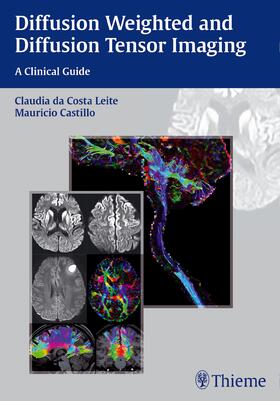 Leite / Castillo |  Diffusion Weighted and Diffusion Tensor Imaging | eBook | Sack Fachmedien
