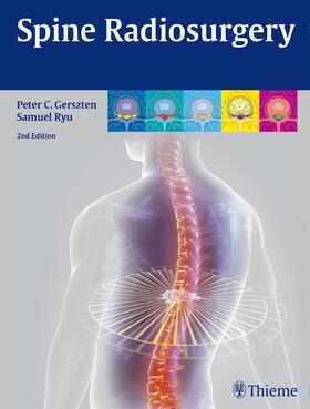 Gerszten / Ryu |  Spine Radiosurgery | eBook | Sack Fachmedien