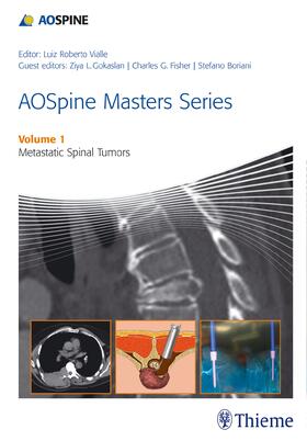 Vialle |  Aospine Masters Series Volume 1: Metastatic Spinal Tumors | Buch |  Sack Fachmedien