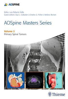 Vialle |  Aospine Masters Series Volume 2: Primary Spinal Tumors | Buch |  Sack Fachmedien