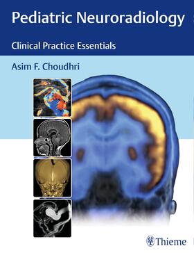Choudhri |  Pediatric Neuroradiology | eBook | Sack Fachmedien