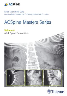 Lenke / Cheung / Vialle |  Aospine Master Series, Vol. 4: Adult Spinal Deformities | Buch |  Sack Fachmedien