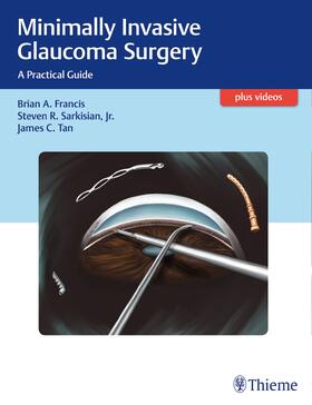 Francis / Sarkisian / Tan |  Minimally Invasive Glaucoma Surgery | eBook | Sack Fachmedien