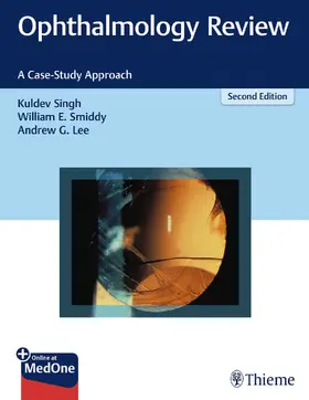 Singh / Smiddy / Lee |  Ophthalmology Review | Buch |  Sack Fachmedien