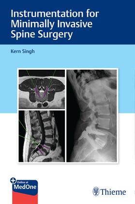 Singh |  Instrumentation for Minimally Invasive Spine Surgery | Buch |  Sack Fachmedien