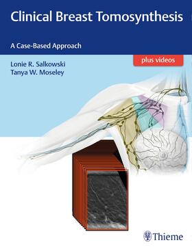 Salkowski / Moseley |  Clinical Breast Tomosynthesis | Buch |  Sack Fachmedien