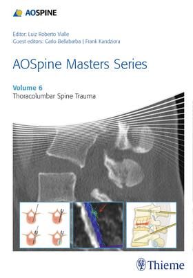 Bellabarba / Kandziora |  AOSpine Masters Series, Volume 6: Thoracolumbar Spine Trauma | eBook | Sack Fachmedien