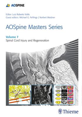 Vialle |  Aospine Masters Series, Volume 7: Spinal Cord Injury and Regeneration | Buch |  Sack Fachmedien