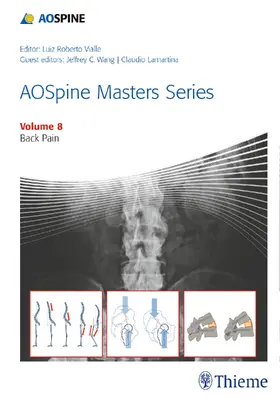 Vialle |  Aospine Masters Series, Volume 8: Back Pain | Buch |  Sack Fachmedien