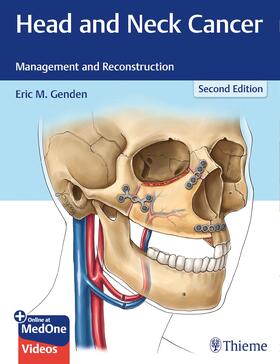 Genden |  Head and Neck Cancer | eBook | Sack Fachmedien