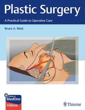 Mast |  Plastic Surgery: A Practical Guide to Operative Care | Buch |  Sack Fachmedien