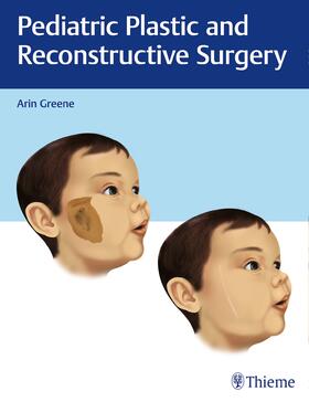 Greene |  Pediatric Plastic and Reconstructive Surgery | Buch |  Sack Fachmedien