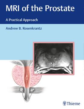 Rosenkrantz |  MRI of the Prostate | Buch |  Sack Fachmedien