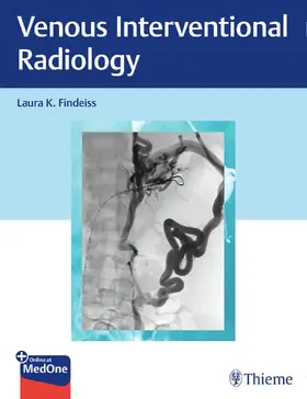 Findeiss |  Venous Interventional Radiology | Buch |  Sack Fachmedien