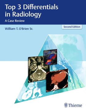 O'Brien |  Top 3 Differentials in Radiology | Buch |  Sack Fachmedien