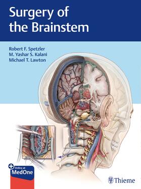 Spetzler / Kalani / Lawton |  Surgery of the Brainstem | Buch |  Sack Fachmedien