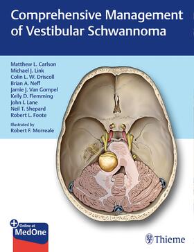 Carlson / Driscoll / Link |  Comprehensive Management of Vestibular Schwannoma | Buch |  Sack Fachmedien