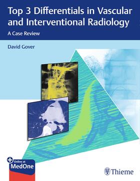 Gover |  Top 3 Differentials in Vascular and Interventional Radiology | Buch |  Sack Fachmedien