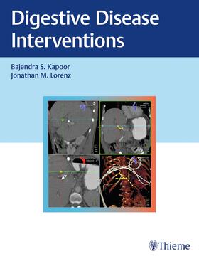 Kapoor / Lorenz |  Digestive Disease Interventions | Buch |  Sack Fachmedien