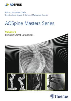 de Kleuver / Berven / Vialle |  AOSpine Masters Series, Volume 9: Pediatric Spinal Deformities | Buch |  Sack Fachmedien