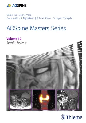 Rajasekaran / Vialle / Kanna |  AOSpine Masters Series, Volume 10: Spinal Infections | eBook | Sack Fachmedien