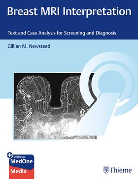 Newstead |  Breast MRI Interpretation | Buch |  Sack Fachmedien