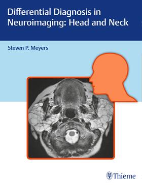 Meyers |  Differential Diagnosis in Neuroimaging: Head and Neck | Buch |  Sack Fachmedien