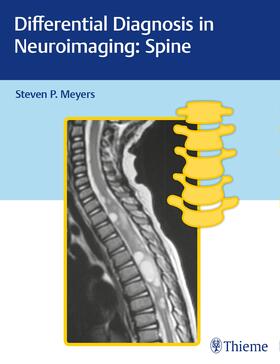 Meyers |  Differential Diagnosis in Neuroimaging: Spine | Buch |  Sack Fachmedien