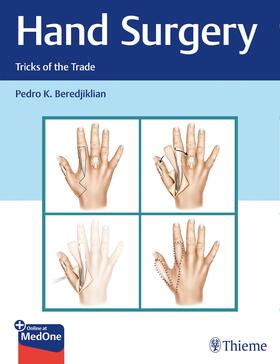 Beredjiklian |  Hand Surgery | eBook | Sack Fachmedien