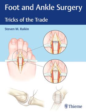 Raikin |  Foot and Ankle Surgery | Buch |  Sack Fachmedien