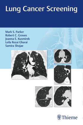 Parker / Groves / Kusmirek |  Lung Cancer Screening | Buch |  Sack Fachmedien