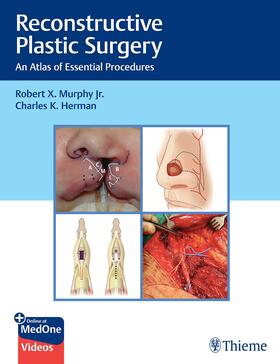 Murphy / Herman |  Reconstructive Plastic Surgery | Buch |  Sack Fachmedien