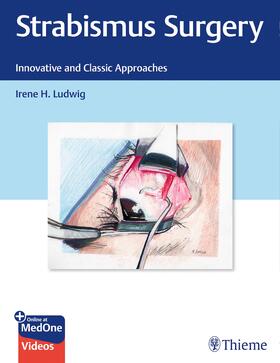 Ludwig |  Strabismus Surgery | Buch |  Sack Fachmedien