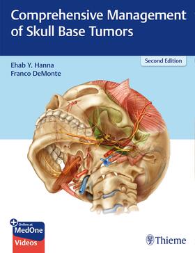 Hanna / DeMonte |  Comprehensive Management of Skull Base Tumors | Buch |  Sack Fachmedien