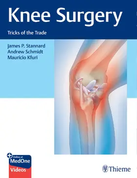 Stannard / Schmidt / Kfuri |  Knee Surgery | Buch |  Sack Fachmedien