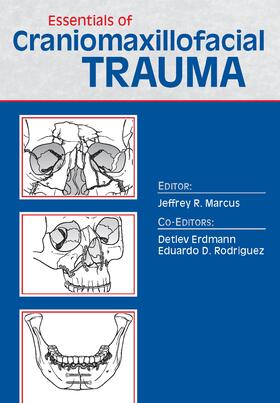 Marcus |  Essentials of Craniomaxillofacial Trauma | Buch |  Sack Fachmedien