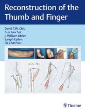 Chiu / Foucher / Littler |  Reconstruction of the Thumb and Finger | Buch |  Sack Fachmedien