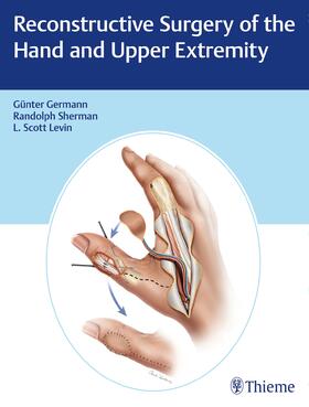 Germann / Levin / Sherman |  Reconstructive Surgery of the Hand and Upper Extremity | Buch |  Sack Fachmedien