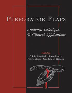 Blondeel / Morris / Neligan |  Perforator Flaps | Buch |  Sack Fachmedien
